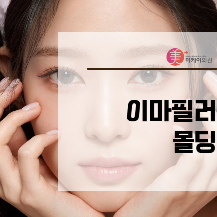 As Forehead Filler Molding Changes the Level of Finish image 1