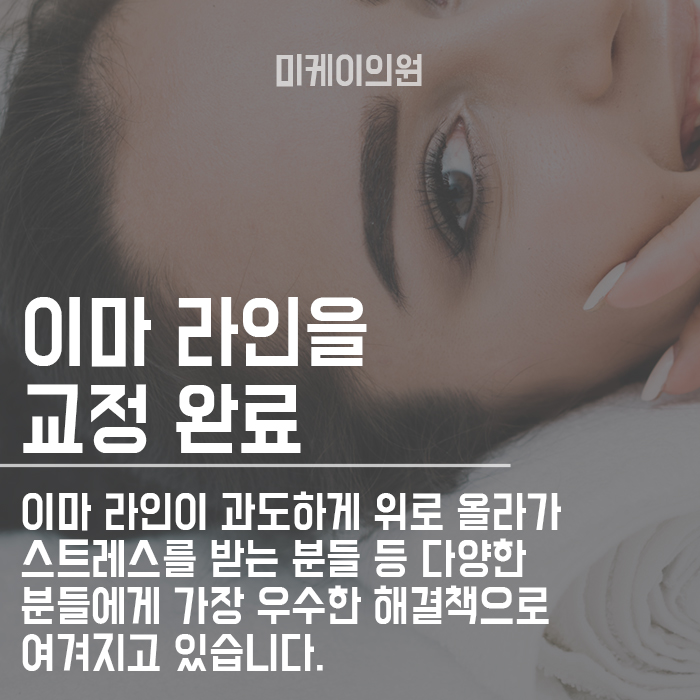 숱이 적은 헤어라인 반영구 자연스럽게 채워요 관련 이미지 6