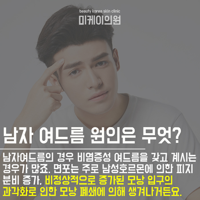 남자여드름관리 상태에 따라 다르게 관련 이미지 2