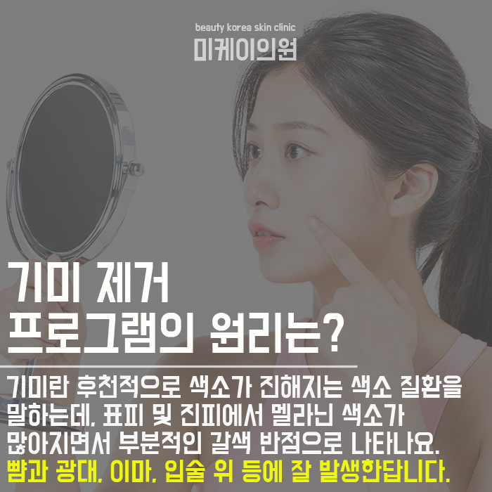 기미타입별치료 많은 분들이 궁금해하시는 정보! 관련 이미지 4