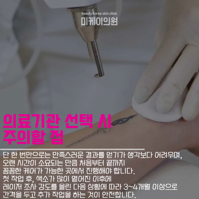 문신제거기간 및 주의사항 살펴보기 관련 이미지 4
