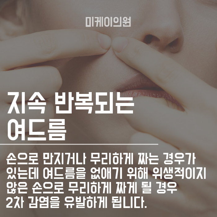 서초여드름의원 원인 그리고 치료방법에 대해 관련 이미지 2