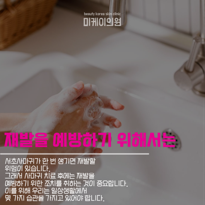 서초사마귀 고민되신다면 미케이로 관련 이미지 5