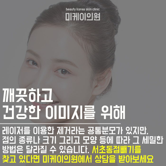 서초동점빼기 개인에 따라 제거방식이 달라 관련 이미지 6