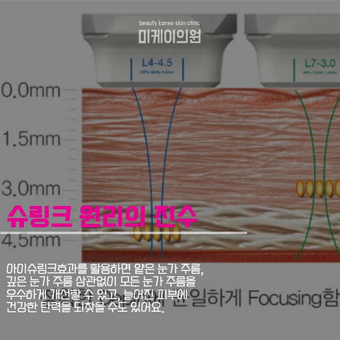 아이슈링크효과로 완성하는 눈가 탄력 리프팅 관련 이미지 2