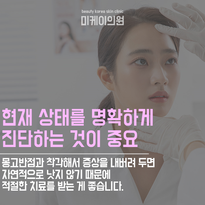 몽고반점제거방법 개인의 피부 타입을 고려해야 관련 이미지 5