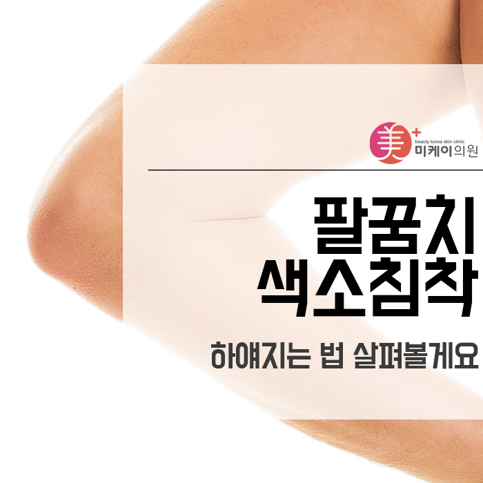 팔꿈치 색소침착 하얘지는 법 살펴볼게요 관련 이미지 1