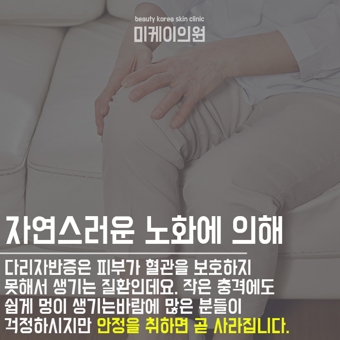 다리자반증 고민하지 말고 케어받으세요 관련 이미지 2
