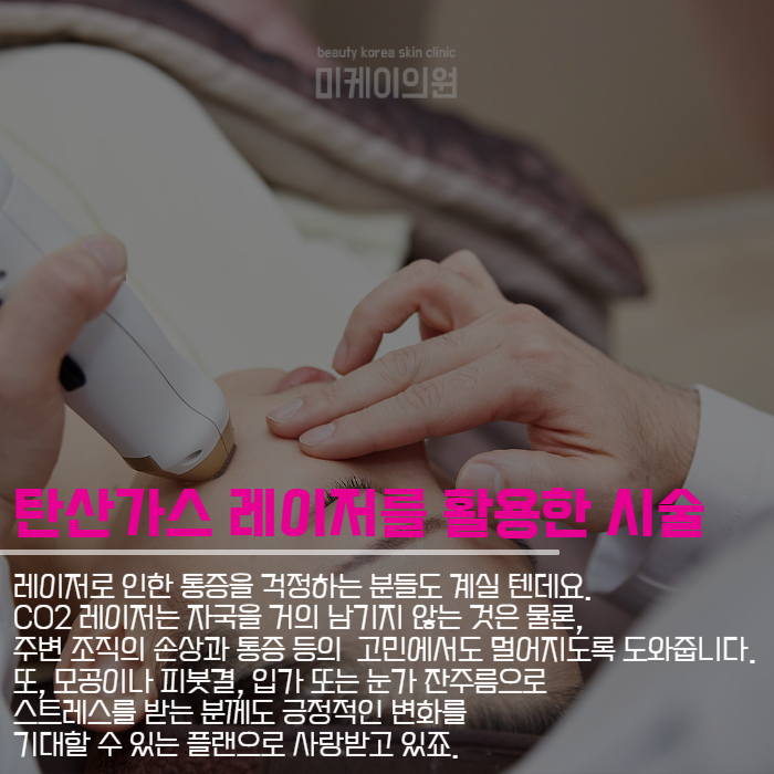 여드름흉터제거레이저 짧은 시간에 간단하게 관련 이미지 5