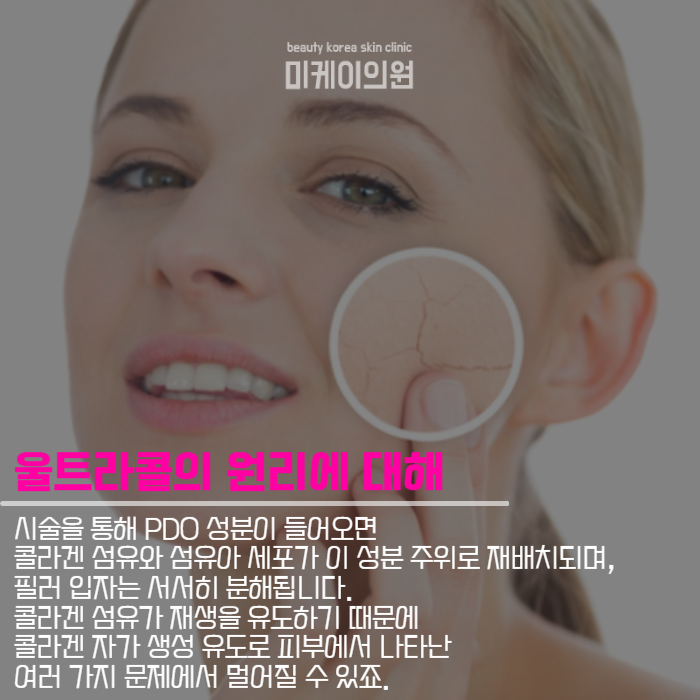 서초동피부과추천 울트라콜 이모저모 관련 이미지 4