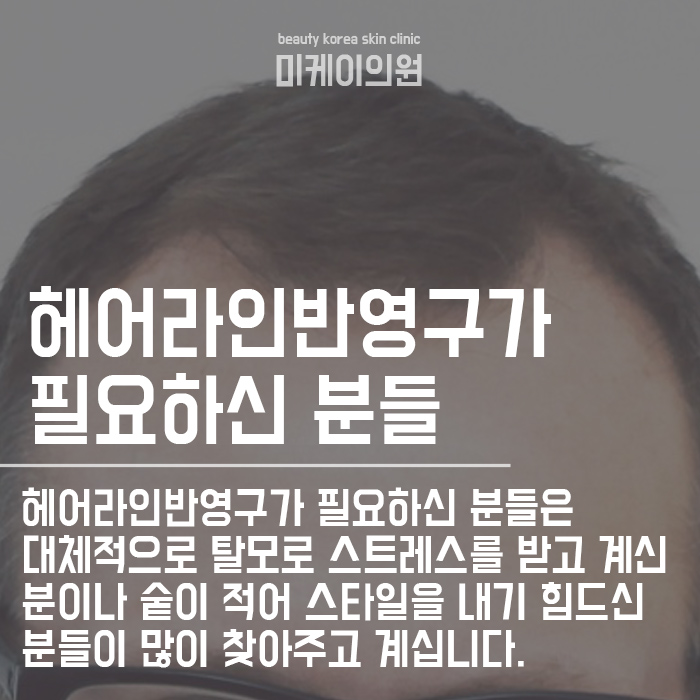서초동헤어라인반영구 이제는 신경 써야 할 때 관련 이미지 3