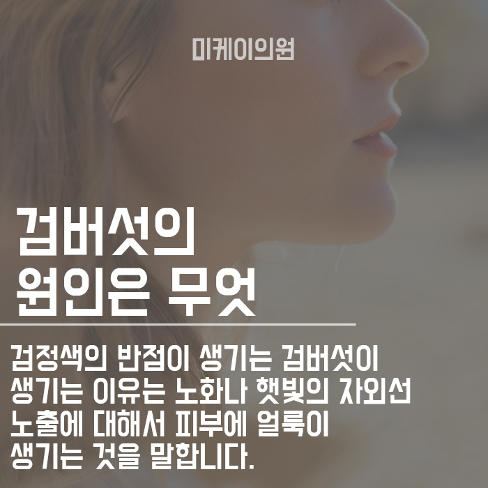검버섯레이저 알아보고 있다면 이곳에서! 관련 이미지 2