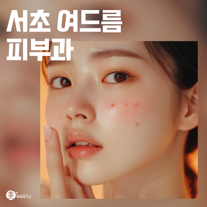 The Start of Acne Skin Care in Seocho image 1