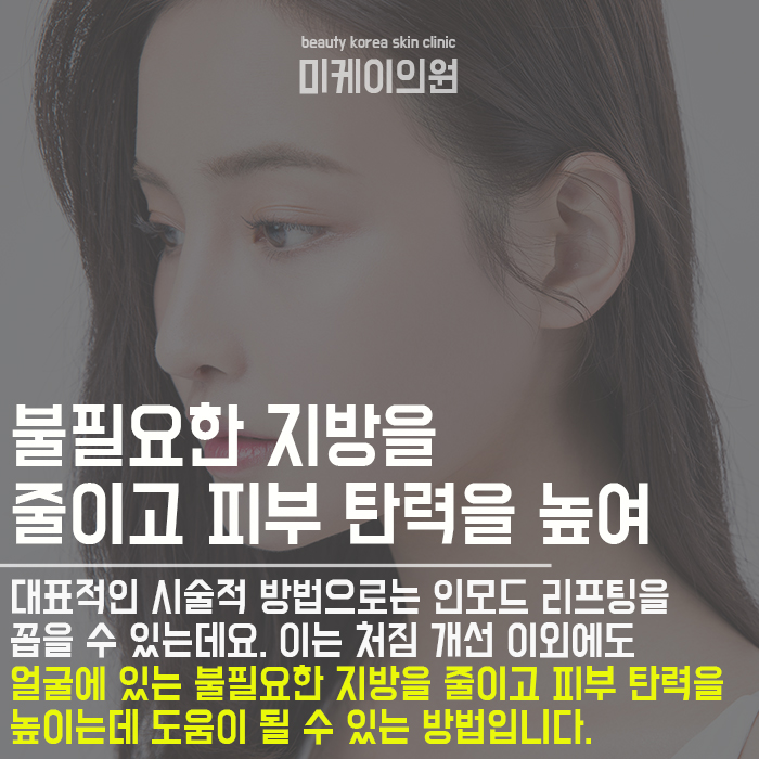서초이중턱리프팅 매끈하고 자연스러운 라인 관련 이미지 2
