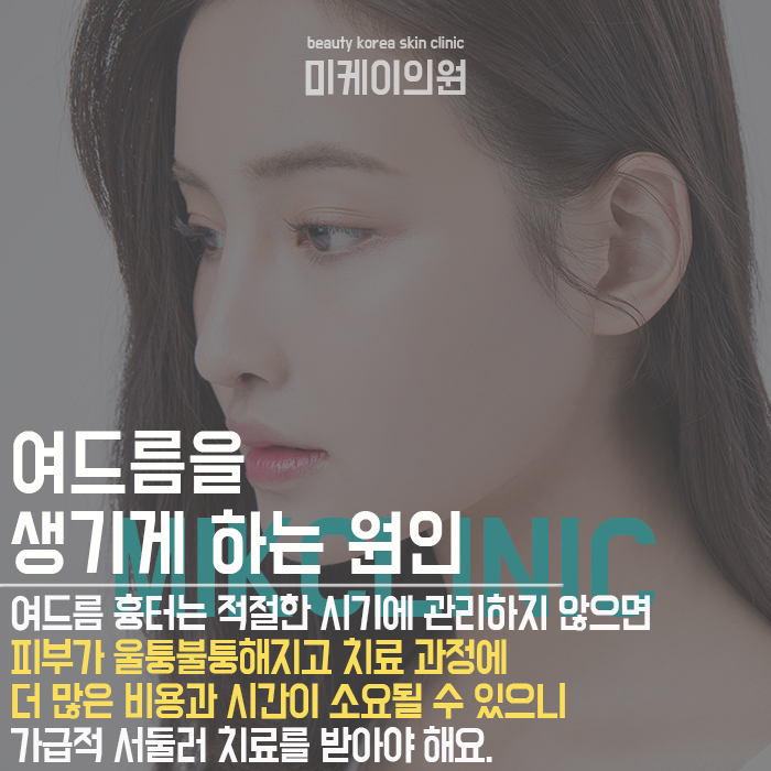 입가여드름나는이유 개인마다 다를 수 있어 관련 이미지 3