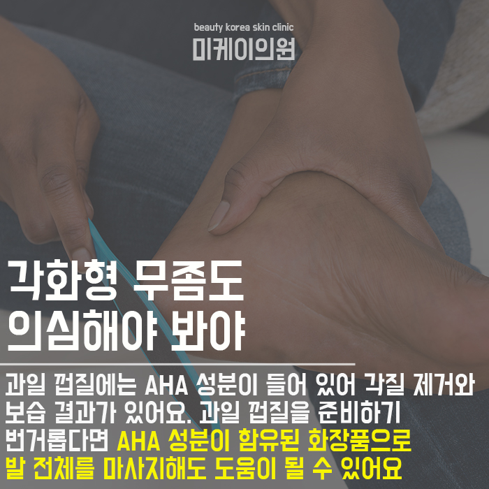 발뒤꿈치관리법 홈케어가 어렵다면 관련 이미지 3