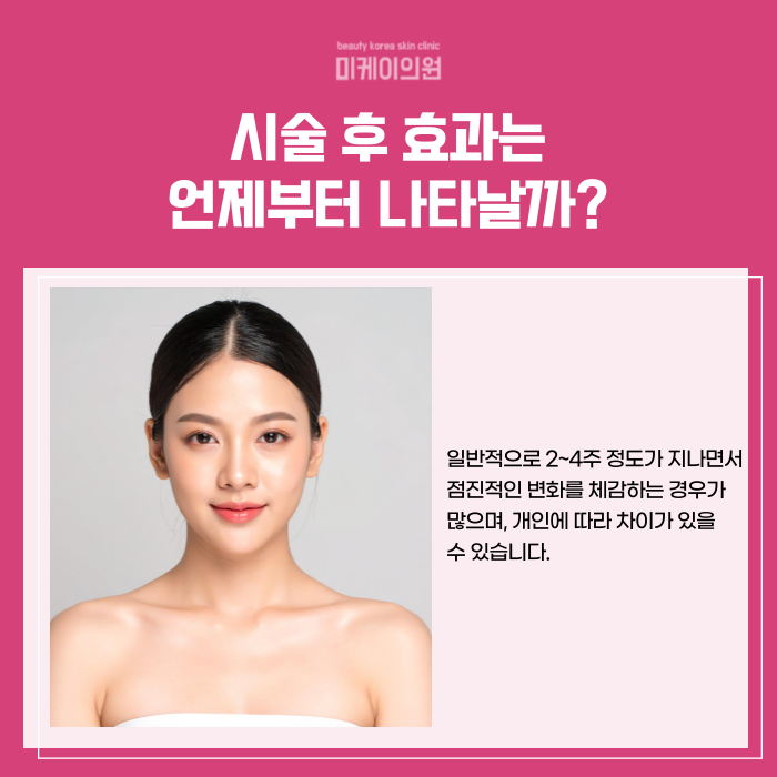 강남역 승모근보톡스 뭉친 어깨라인 개선 관련 이미지 4