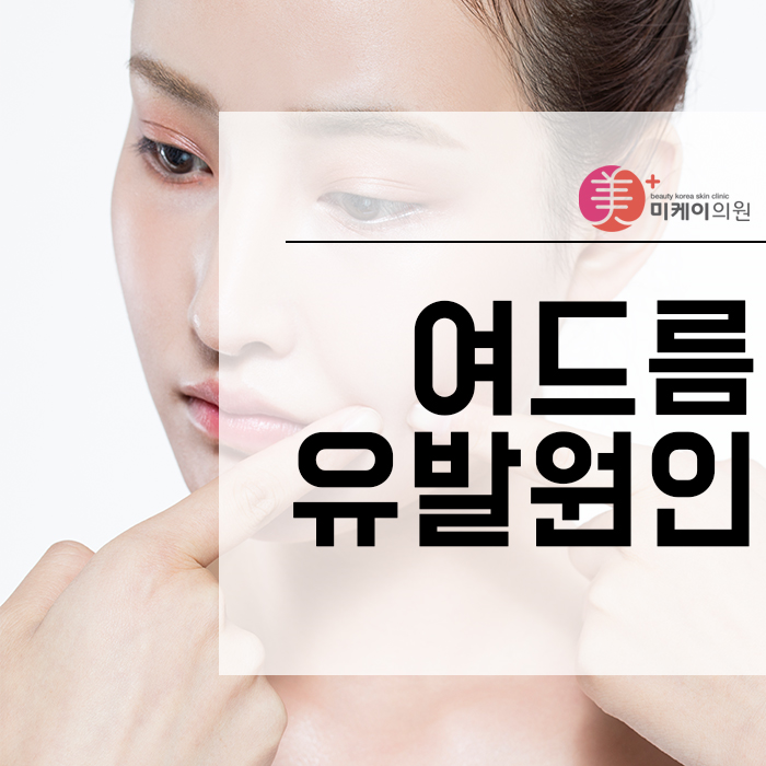 여드름유발원인 무엇 때문일까? 관련 이미지 1