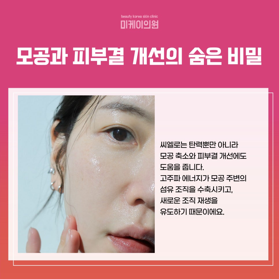 강남 피부과의원 씨엘로 시술의 모든 것 관련 이미지 3