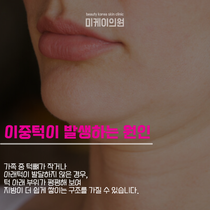 강남 이중턱관리 하나로 자신감 되찾기 관련 이미지 2