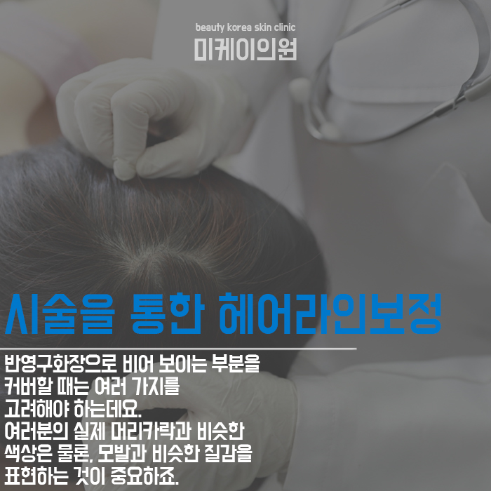 헤어라인보정 내 것 같은 자연스러움은 관련 이미지 3
