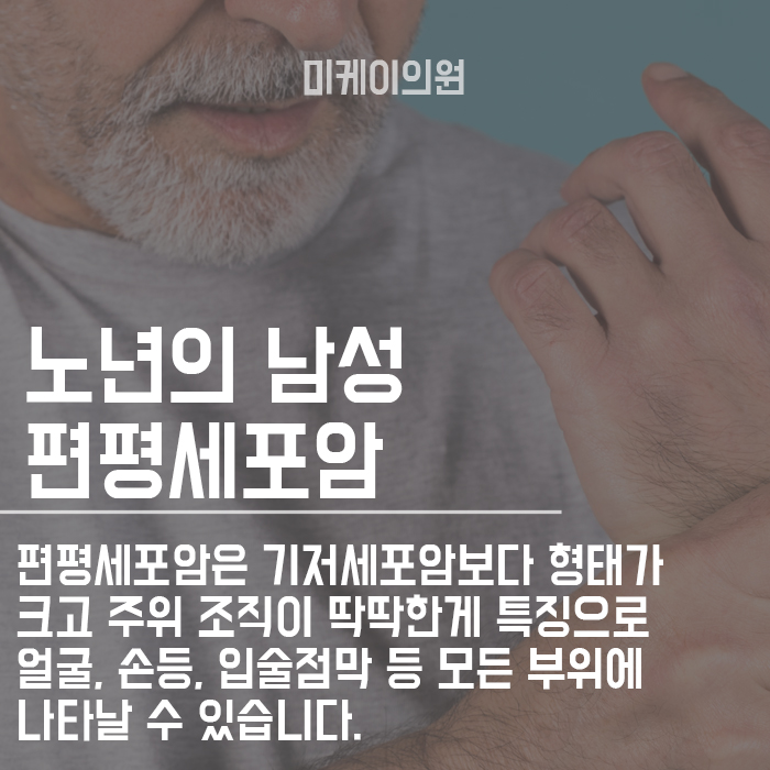 피부암초기증상 잘 읽어보고 초기에 대처해요 관련 이미지 3