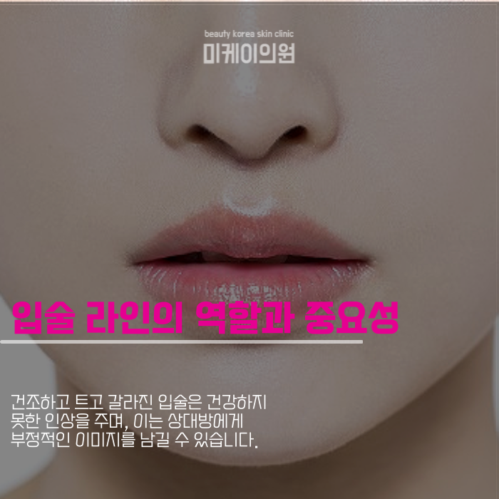 강남역 입꼬리필러로 매력적인 인상 만들기 관련 이미지 2