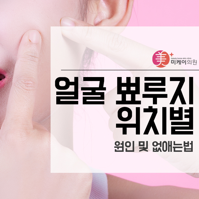얼굴 뾰루지 위치별 원인 및 없애는법 함께 확인해 보아요 관련 이미지 1