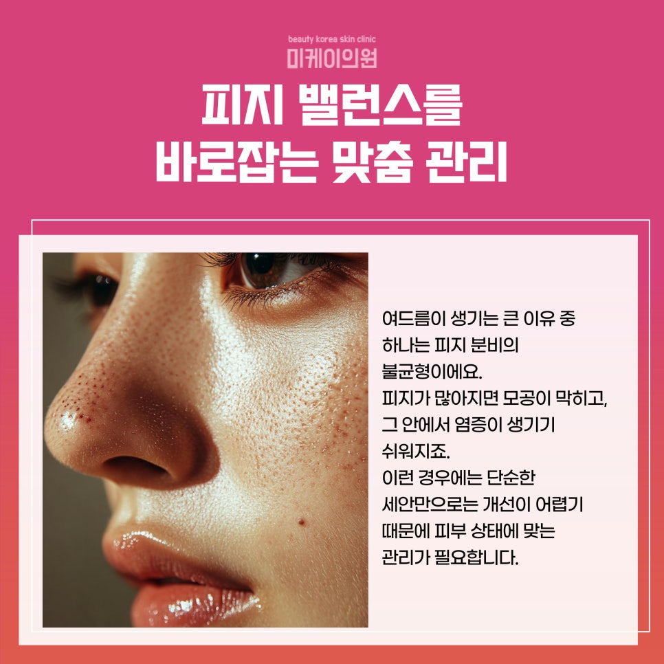 Start Gangnam Acne Treatment the Right Way image 2