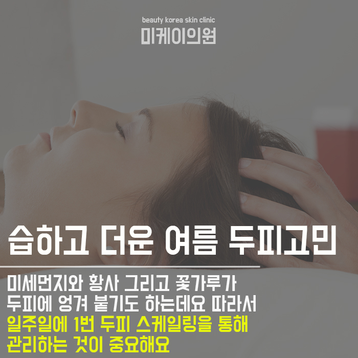 여름철머리두피관리 어렵지 않아 관련 이미지 2