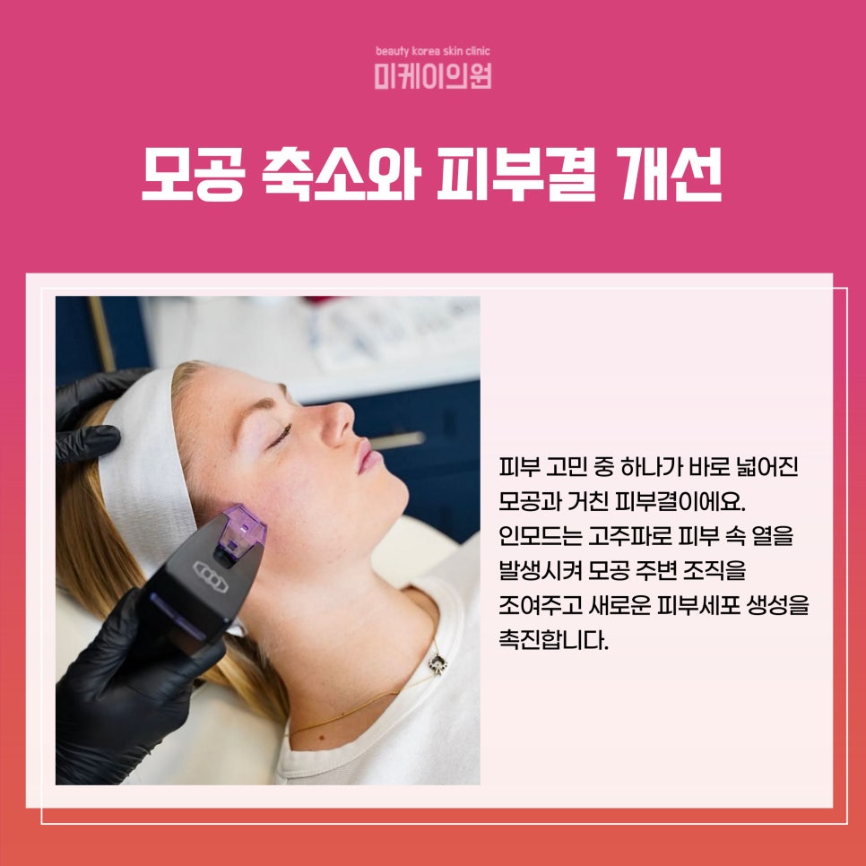 강남역 인모드 효과로 탄력과 윤기 되찾기 관련 이미지 3