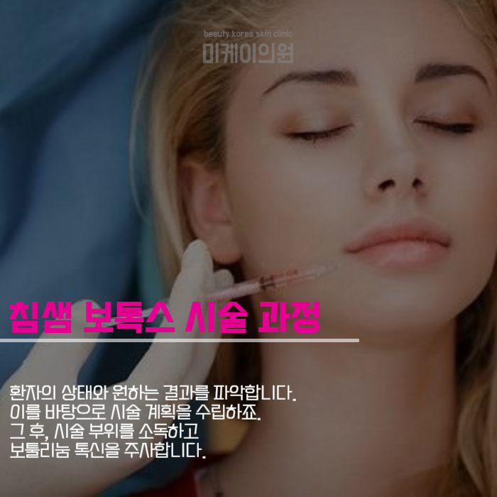 강남역 침샘보톡스 턱선 콤플렉스 해소 관련 이미지 5