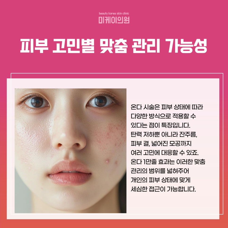 Creating Firm Skin with the Onda 10,000-Line Effect image 4