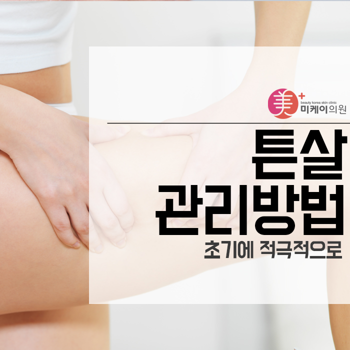 튼살관리방법 초기에 적극적으로 관련 이미지 1