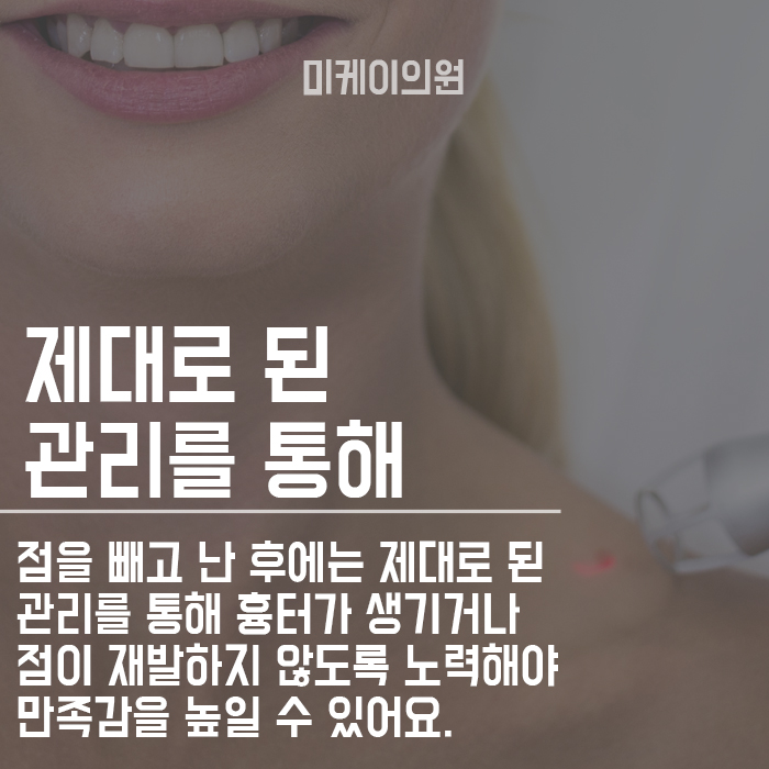 점제거 후 제대로 된 관리방법 관련 이미지 6