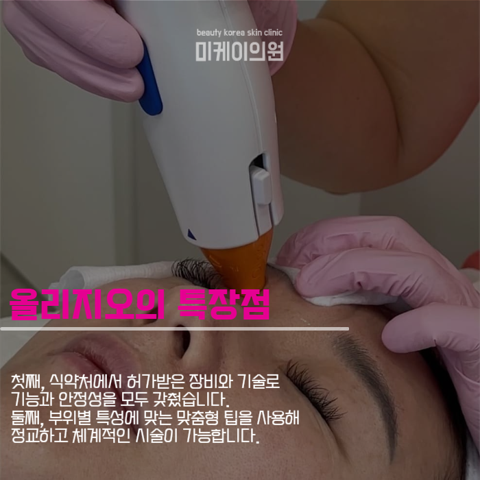 Oligio Treatment Intervals for a Smooth Facial Line image 3