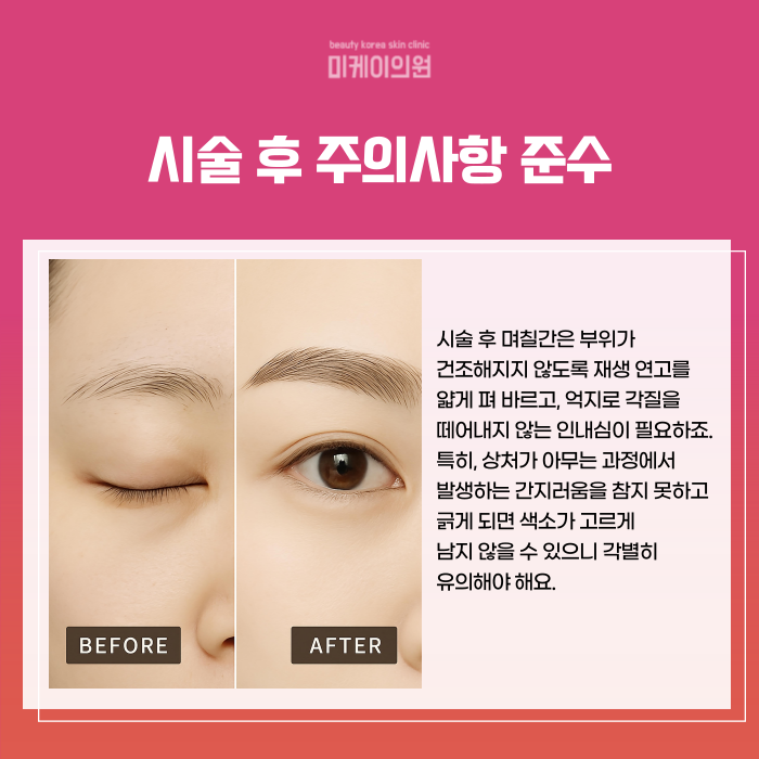 강남 반영구 잘하는곳 찾으시나요 관련 이미지 5