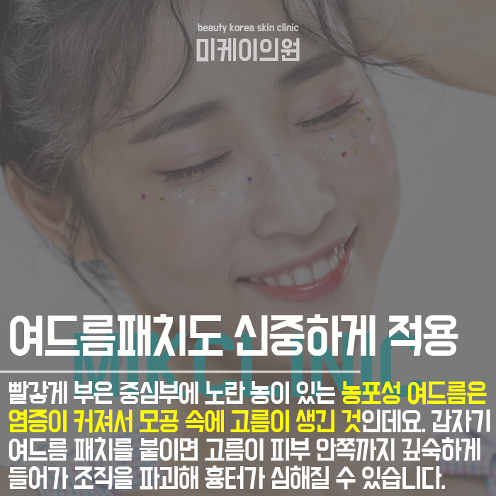 강남역여드름압출잘하는곳 깨끗한 피부를 회복하려면 관련 이미지 5