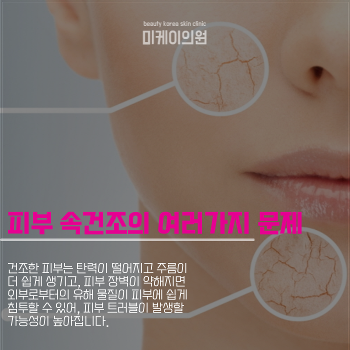 강남역 리쥬란힐러 속건성이 고민일때 관련 이미지 2