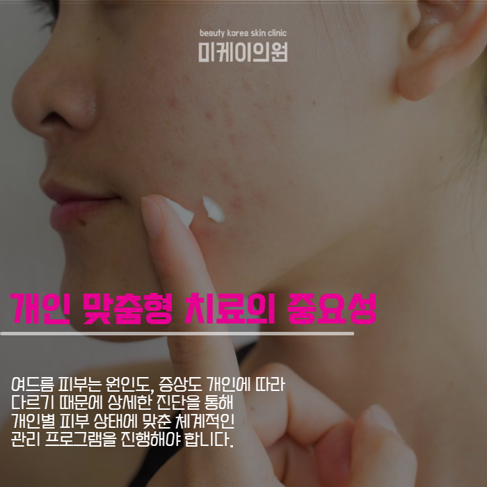 강남역 전문의 피부과 제공하는 맞춤형 여드름 치료 관련 이미지 3