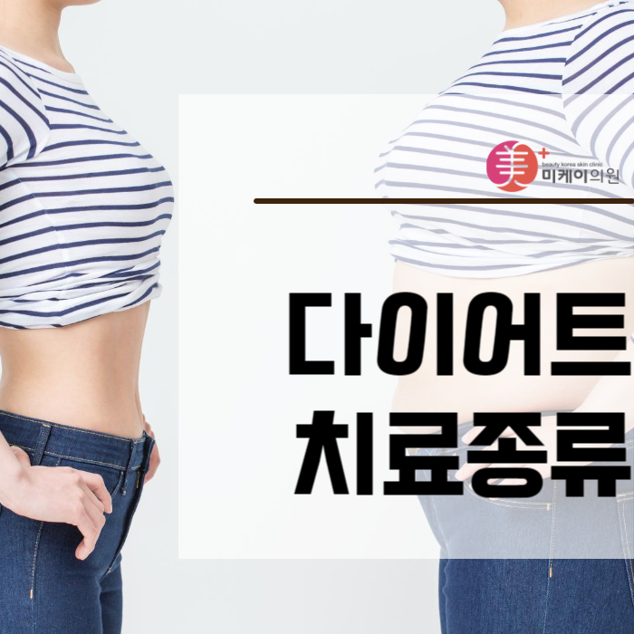다이어트치료종류 대해서 궁금하시다면 관련 이미지 1