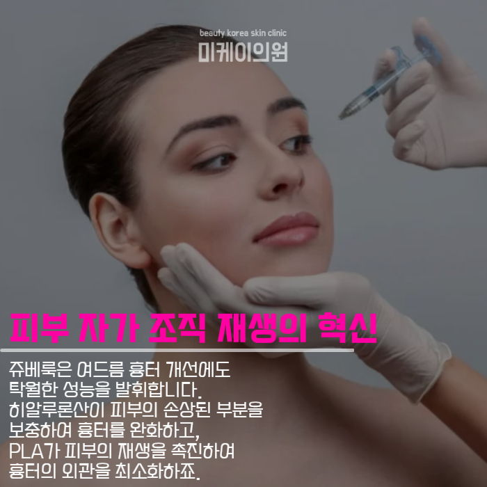 스킨부스터종류 및 기능 소개 관련 이미지 4