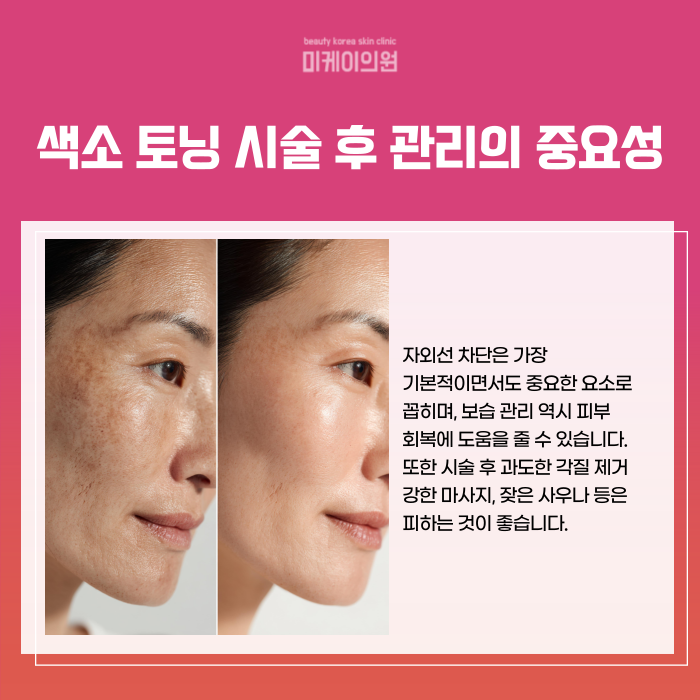 강남 일요일 피부과 색소침착 관리의 이해 관련 이미지 6