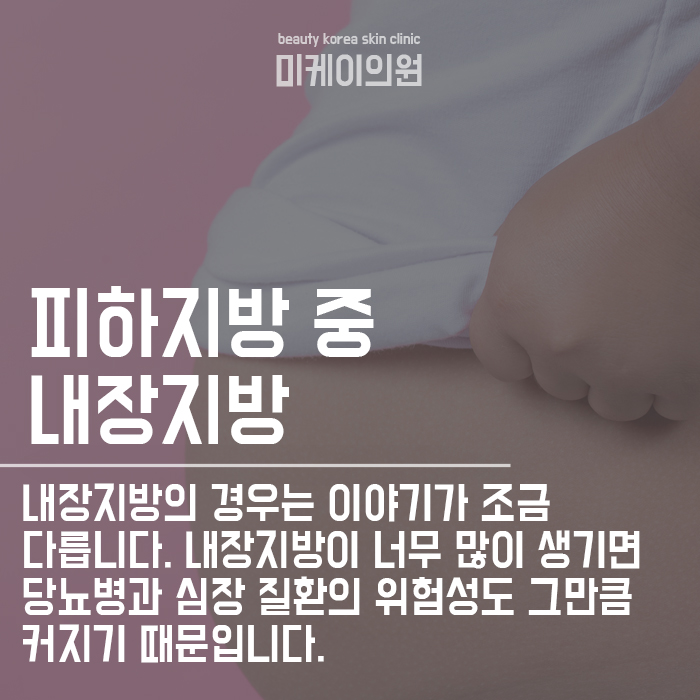 피하지방 내장지방 빼는 방법 차이가 있다? 관련 이미지 2