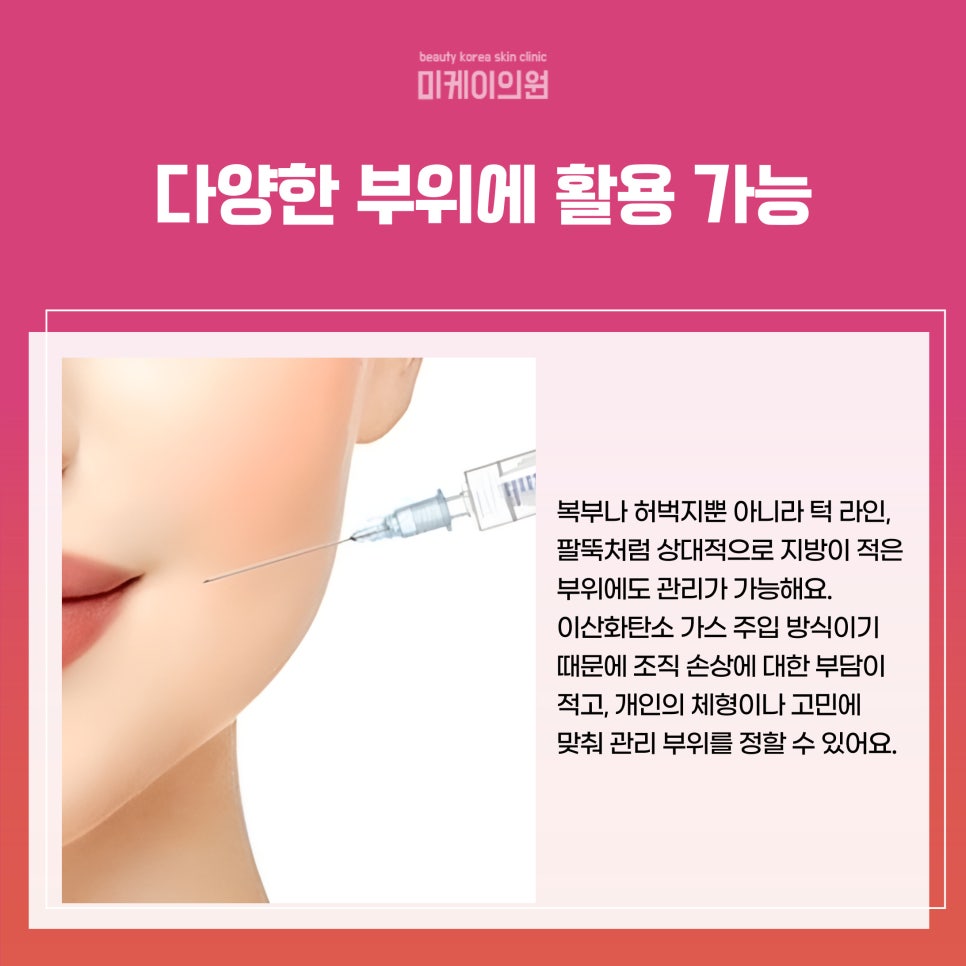 Why Is Carboxy, the Weight-Loss Injection at Gangnam Station, So Popular? image 4