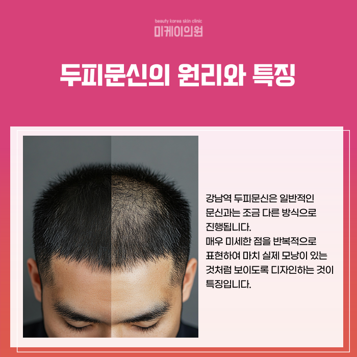 Gangnam Station Scalp Micropigmentation: How to Naturally Cover Thinning Hair image 2