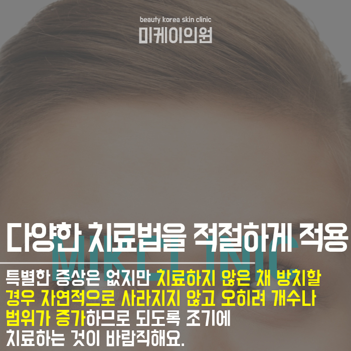 한관종생기는이유 개인마다 다를 수 있어 관련 이미지 5