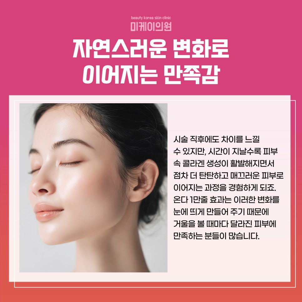 Creating Firm Skin with the Onda 10,000-Line Effect image 5