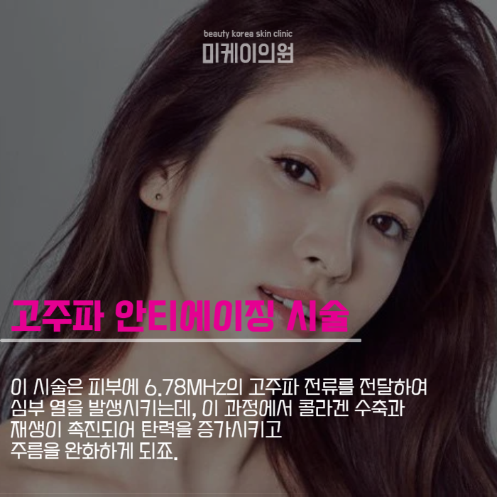 팔자주름없애는시술 올리지오 리프팅 인기 관련 이미지 2