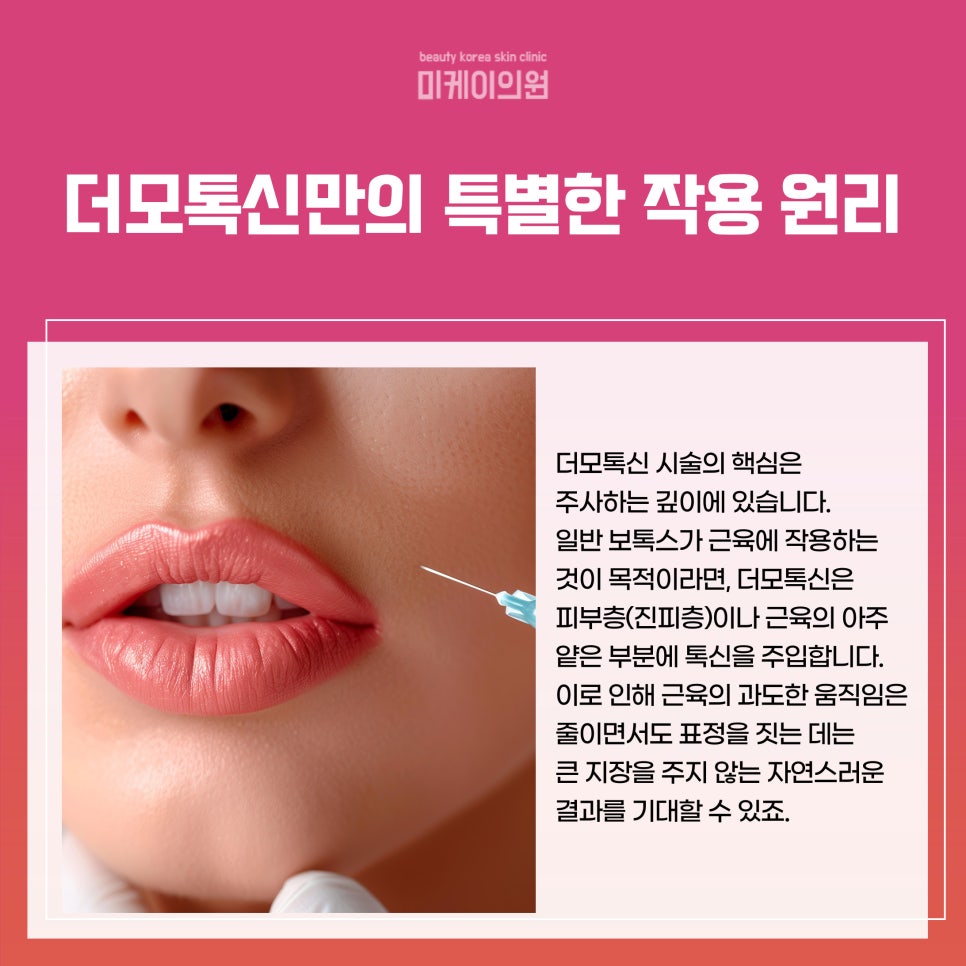 Guide to the Difference Between Dermotoxin and Botox in Gangnam image 2